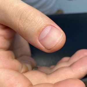 Men's thumb with perfect nail